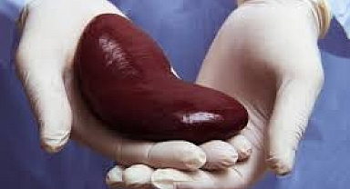 İlk başarılı organ nakli