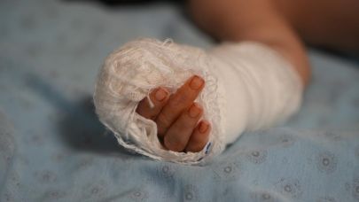 Serum kelebeğini çıkarmak isterken bebeğin parmağını kesti