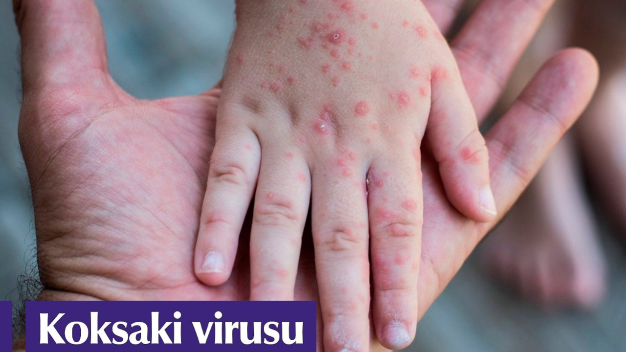 Denizlerimizde virüs tehdidi gerçekse kendinizi ve çocuklarınızı koruyun