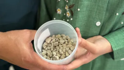Vücudundan 287 tane taş çıkarıldı