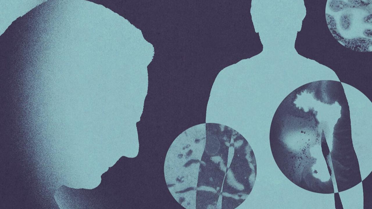 Gençlerde Kanser Vakaları Neden Artıyor? Bilim İnsanları 1950’lere Uzanan İzleri Takip Ediyor