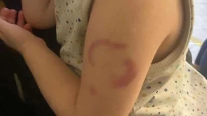 Öğretmenden ilginç savunma: "Isırmadım öperken oldu"