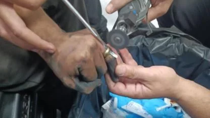 Parmakta sıkışan yüzük, doktor ve itfaiye ekibi tarafından çıkartıldı