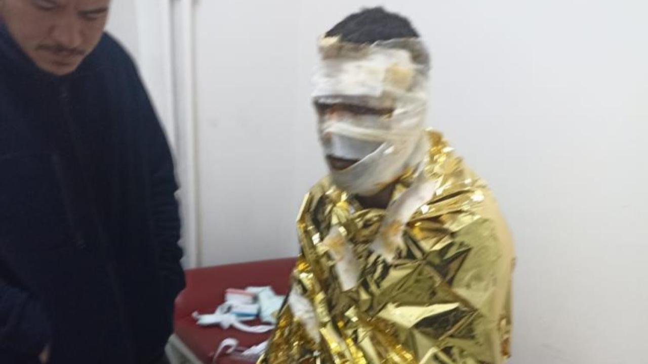 Erzurum'da kömür ocağında yangın: 2 işçi yaralı