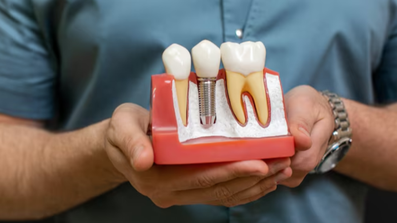 SGK implantı karşılasın kanun teklifi mecliste