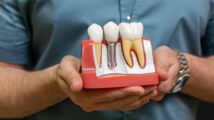 SGK implantı karşılasın kanun teklifi mecliste