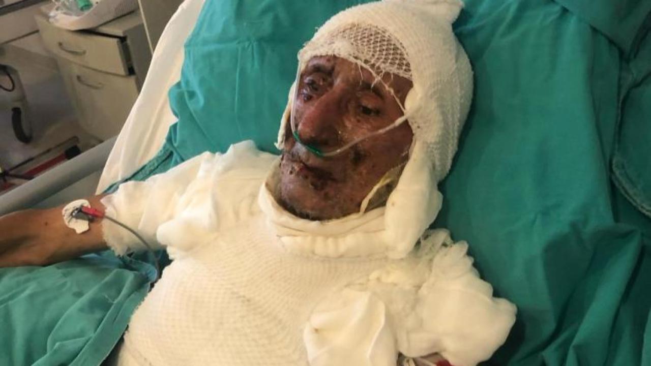 Cide’de Miras Kavgası Cehenneme Döndü! Ağabeyini Yakmaya Çalıştığı İddia Edilen Kardeş Hakim Karşısında!