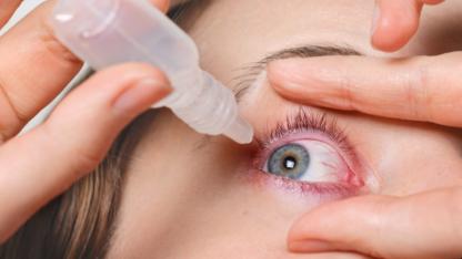 Gözleriniz Çapaklanıyorsa Dikkat! Salgın Kapıda: Bu 3 Şeye Dikkat Etmeyen Görme Kaybı Yaşayabilir