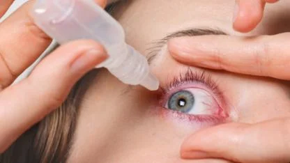 Gözleriniz Çapaklanıyorsa Dikkat! Salgın Kapıda: Bu 3 Şeye Dikkat Etmeyen Görme Kaybı Yaşayabilir