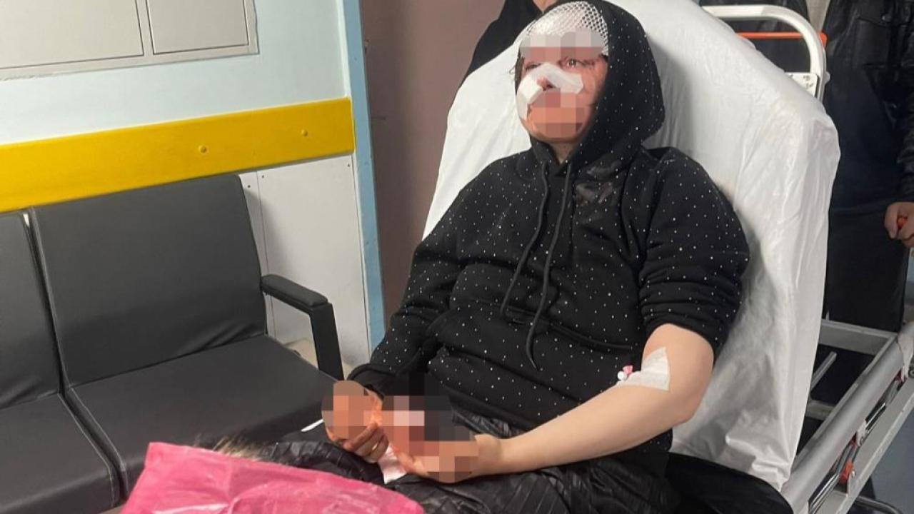 Kadına Şiddet Bu Kez Adliye Kapısında: Boşanmak isteyen eşini öldüresiye darp etti