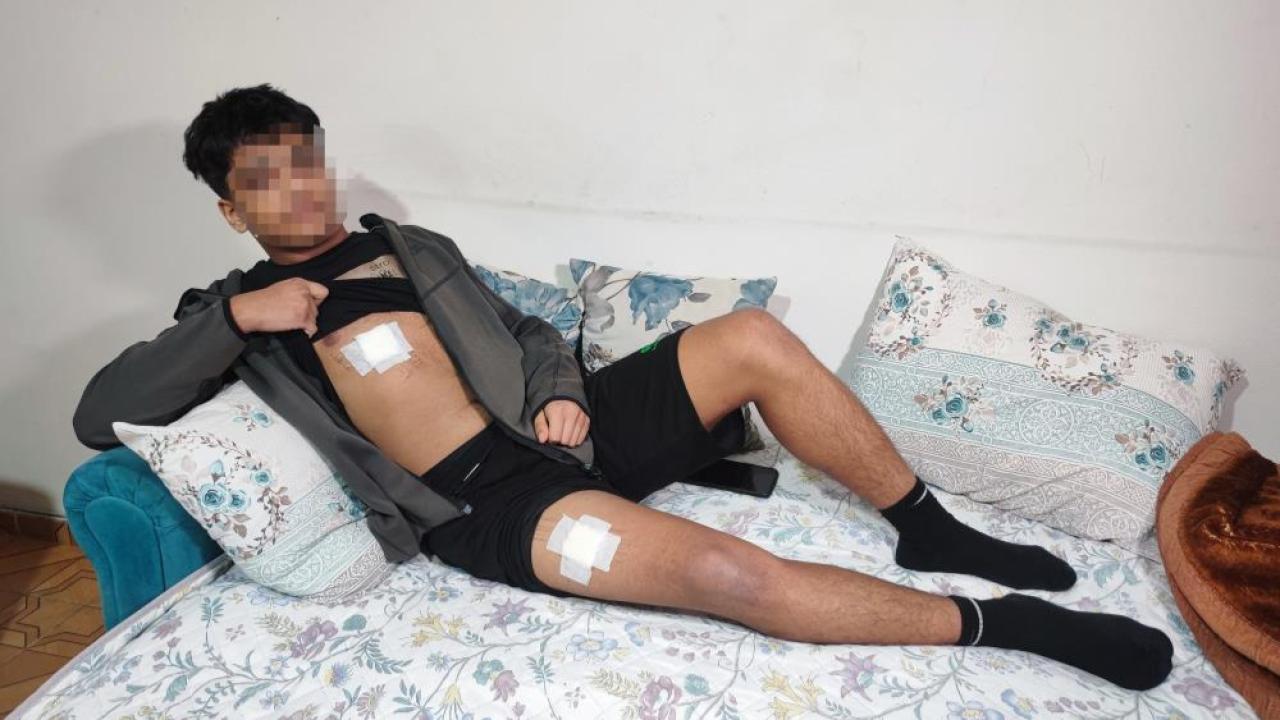 Adana’da Akran Zorbalığı Vahşete Dönüştü: 15 Yaşındaki Çocuğu 3 Yerinden Bıçaklayıp Dalga Geçtiler!