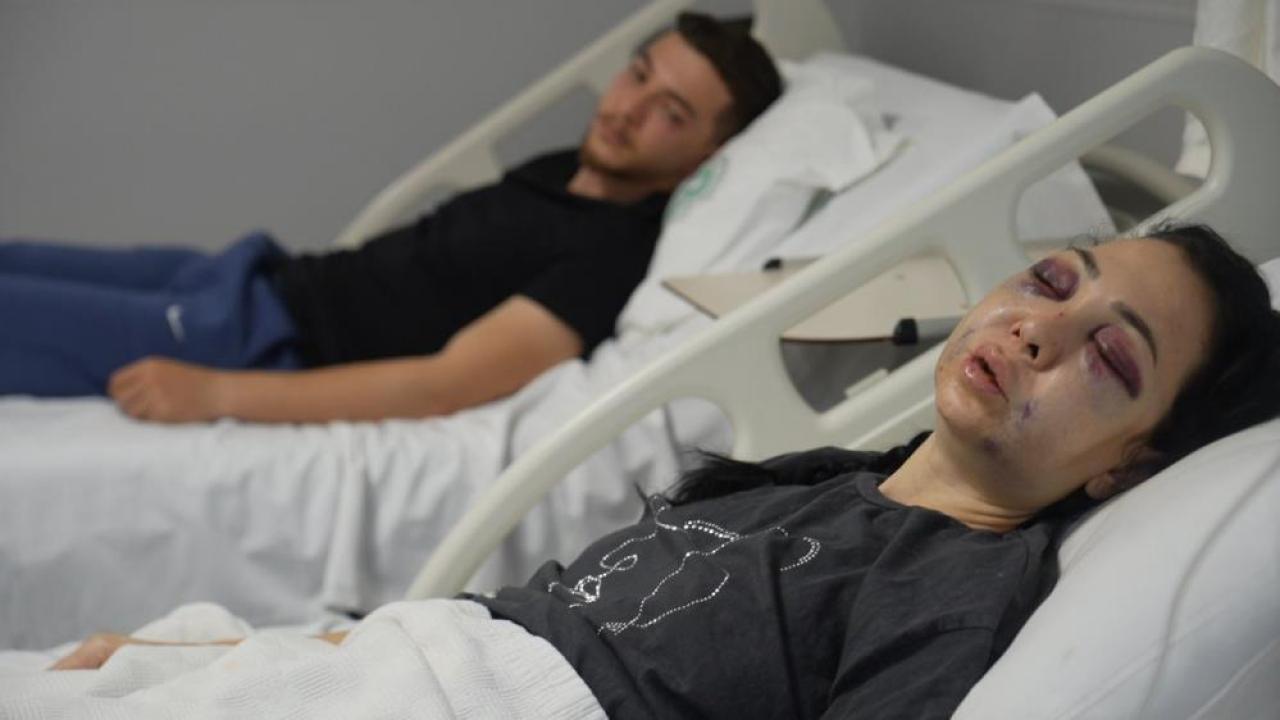 Oğlunun gözü önünde anneyi öldüresiye dövdüler: "'Küfür etmeyin' dedik diye bu hale geldim"