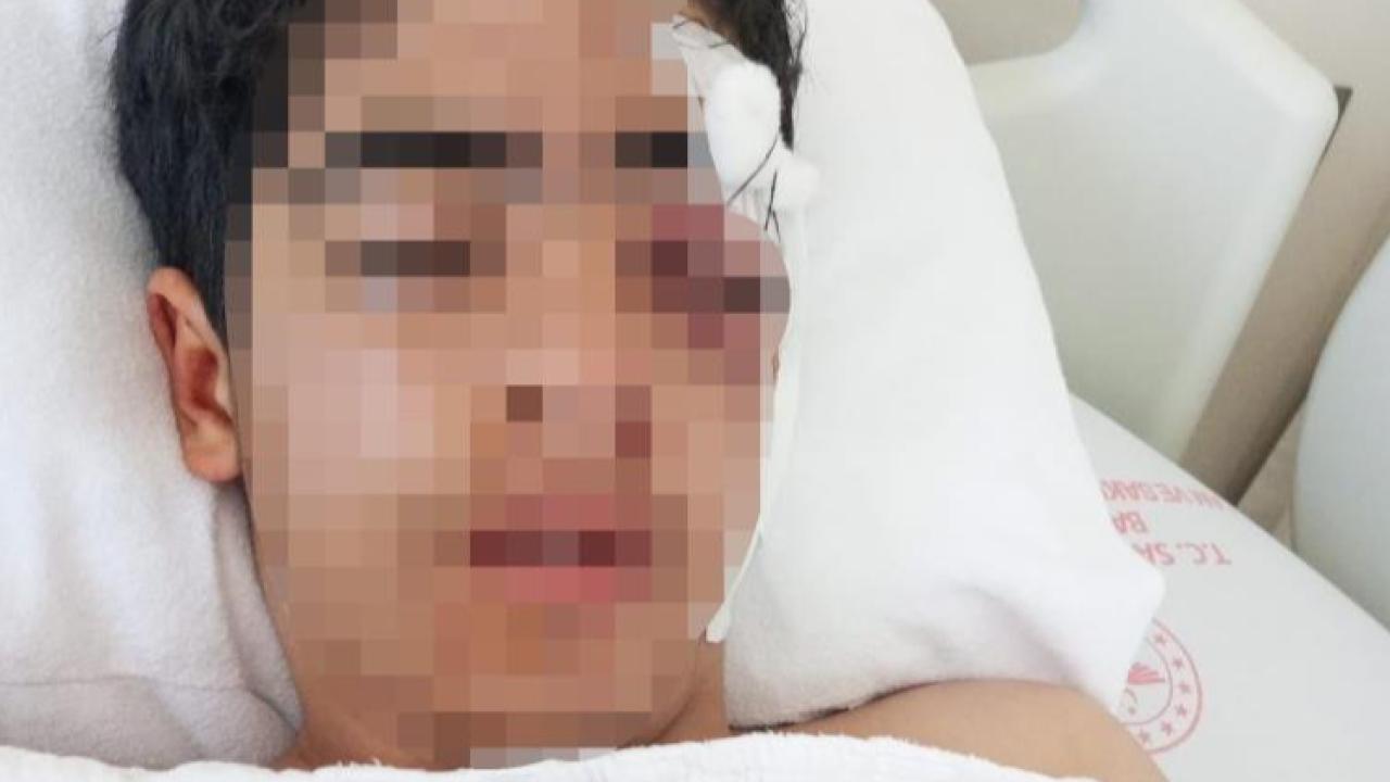 Akran zorbalığına bir yenisi eklendi: 15 yaşındaki çocuk muştayla öldüresiye dövüldü