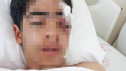Akran zorbalığına bir yenisi eklendi: 15 yaşındaki çocuk muştayla öldüresiye dövüldü