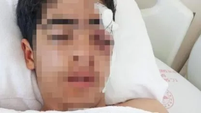 Akran zorbalığına bir yenisi eklendi: 15 yaşındaki çocuk muştayla öldüresiye dövüldü