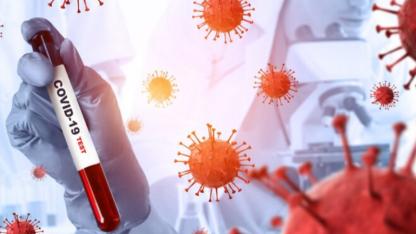 Pandemi Geri mi Geliyor? DSÖ 23 Ülkede Görülen Yeni Varyant İçin Düğmeye Bastı!