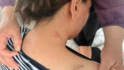 Türkiye Bu Olayı Konuşuyor: 17 Bıçak Darbesine Rağmen Ölü Taklidi Yaparak Hayatta Kaldı